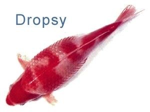 dropsy